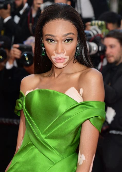 winnie harlow net worth|Winnie Harlow Net Worth 2024: From Runway to Riches